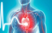 Những ảnh hưởng đến tim mạch của hậu COVID-19